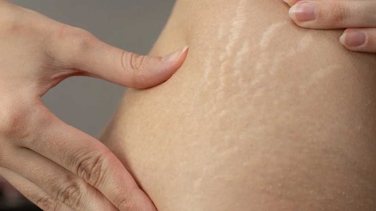 Challenges and Limitations