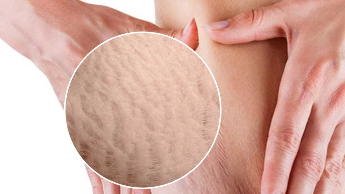 Intersection with Weight Loss and Bariatric Surgery