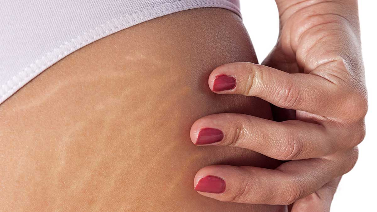 Psychological Benefits of Garment Therapy