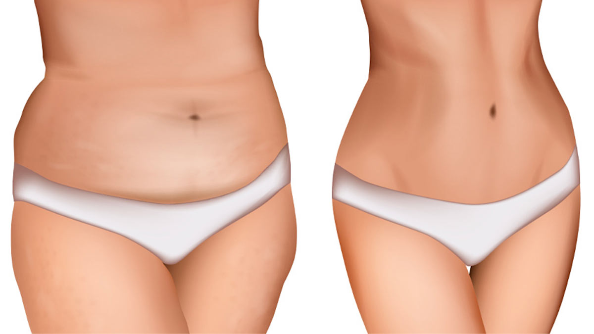 Post Surgery Care and Gradual Transition