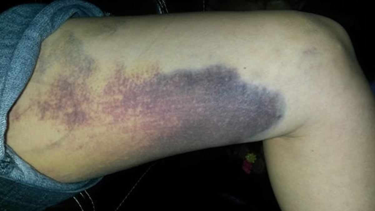 The Connection Between Body Temperature and Healing