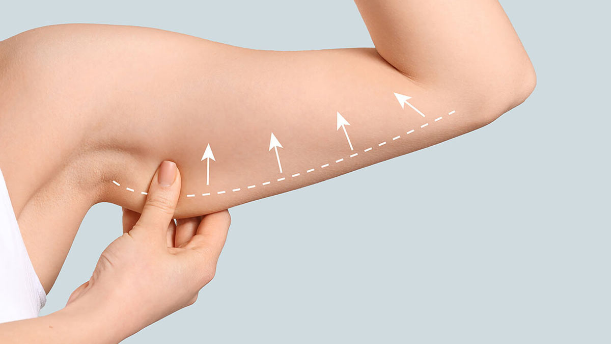 Combining Arm Workouts with Full-Body Exercises