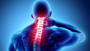 Complications of a broken neck